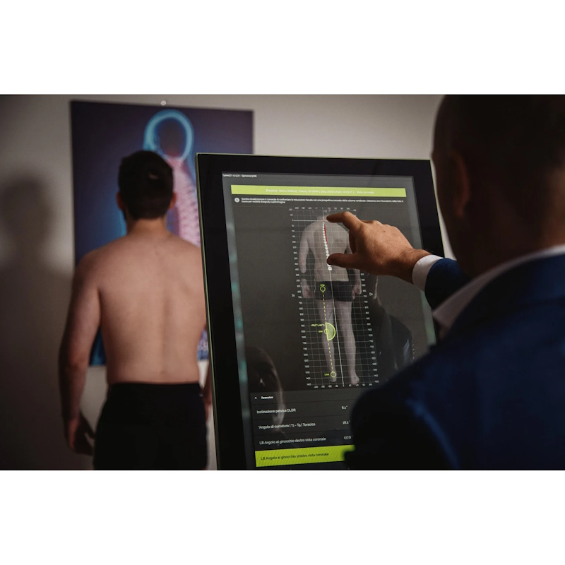 Система 3D-диагностики позвоночника Sensor Medica Spine3D